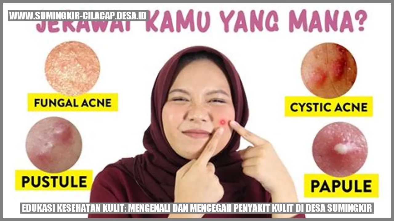 Edukasi Kesehatan Kulit